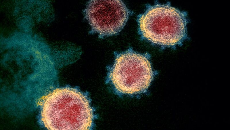 File:Novel Coronavirus SARS-CoV-2-900x508.jpg